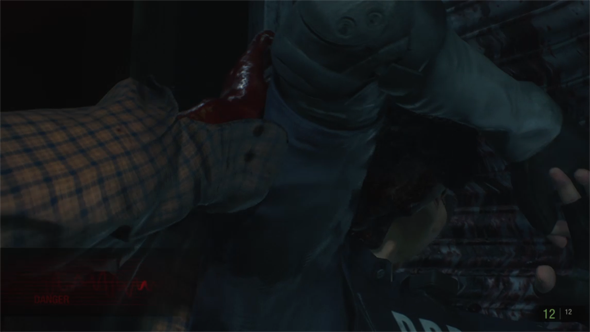 Resident Evil 2 - zombie bite