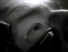 Picard's tear